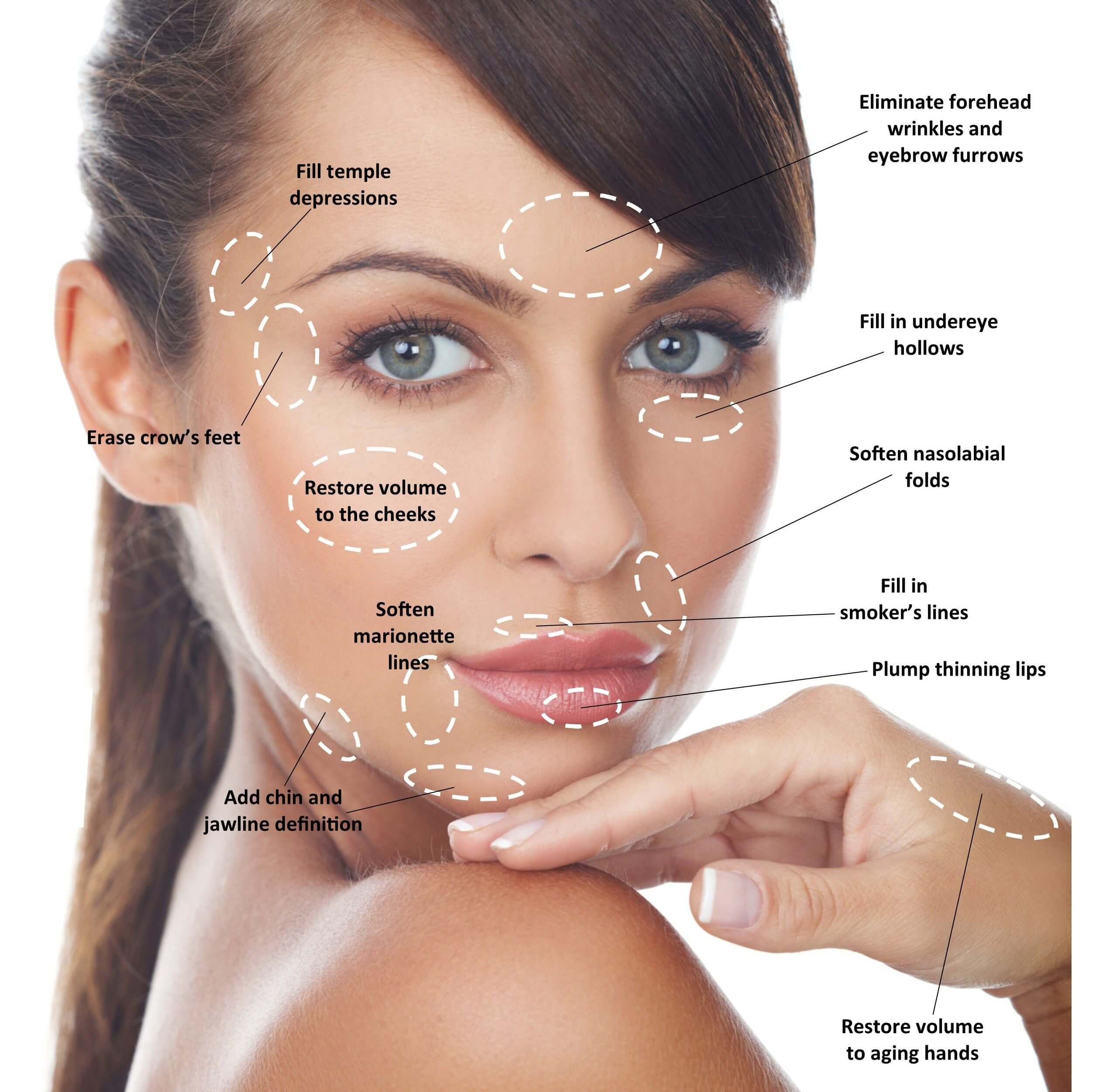 Carbon peel gentle laser care aesthetics Tustin & Long Beach california